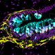 Ear organoid with hair cells in blue. Image: Indiana University School of Medicine